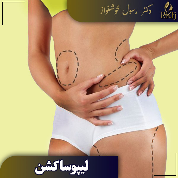 لیپوساکشن