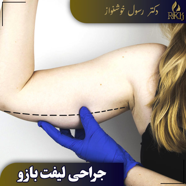 جراحی لیفت بازو