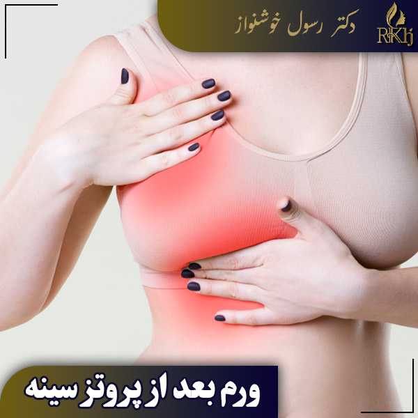 ورم بعد از پروتز سینه