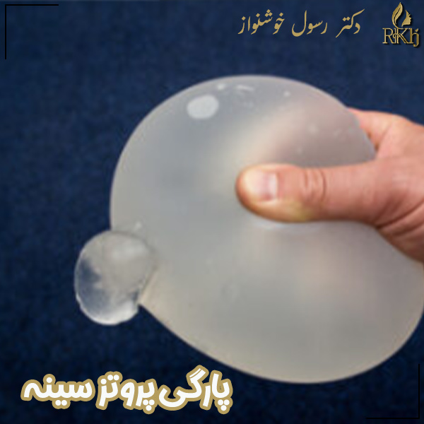 پارگی پروتز سینه - دکتر رسول خوشنواز