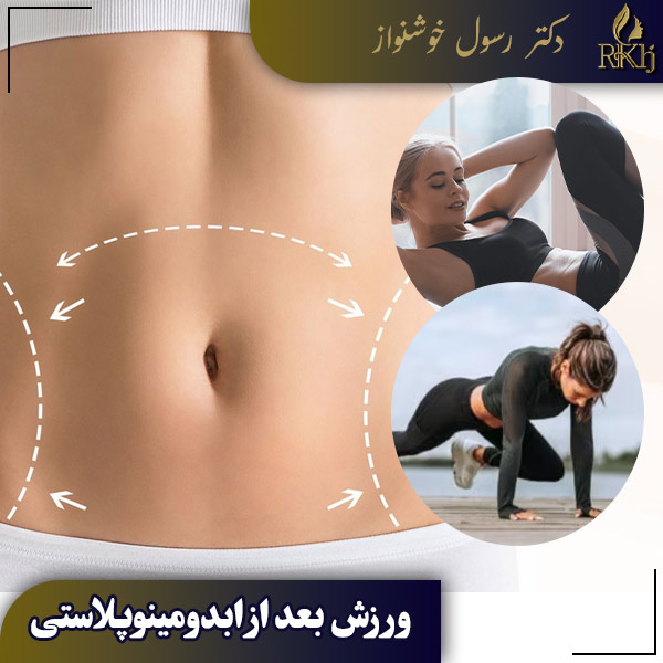 ورزش بعد از ابدومینوپلاستی