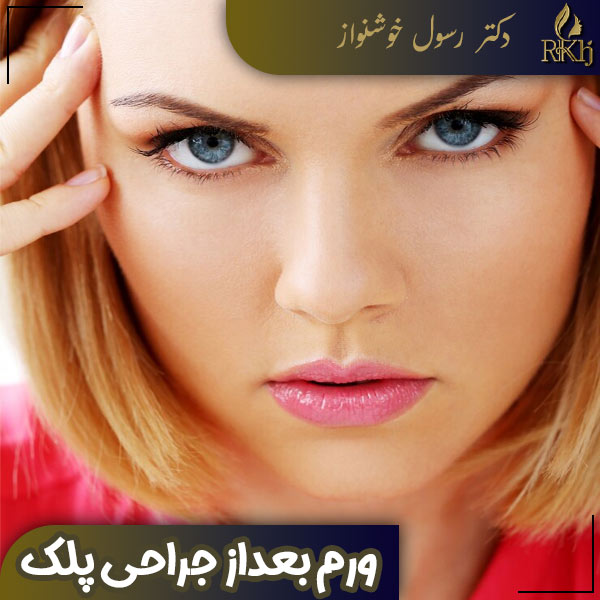 ورم بعد از جراحی پلک - دکتر رسول خوشنواز