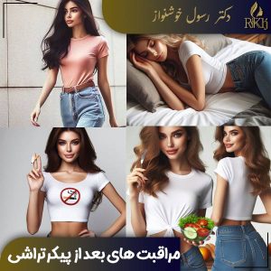 مراقبت های بعد از پیکرتراشی - دکتر رسول خوشنواز - drkhoshnavaz.com