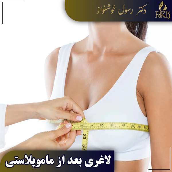 لاغری بعد از ماموپلاستی